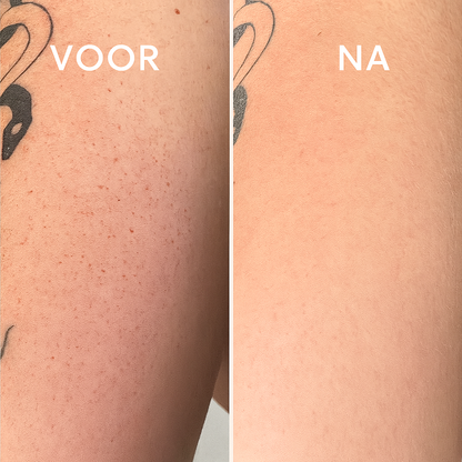 DermaSoft™ – Exfoliërende Handschoen